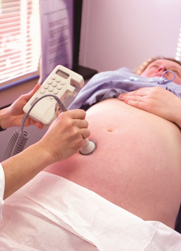 Monitor fetal durante el examen de ultrasonido del 5to mes