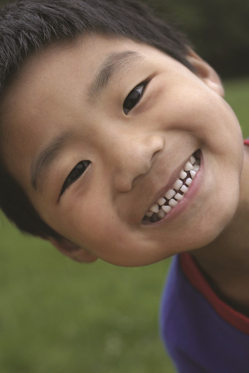 Cara de una(a) niño pequeño sonriente mostrando sus dos hileras de dientes
